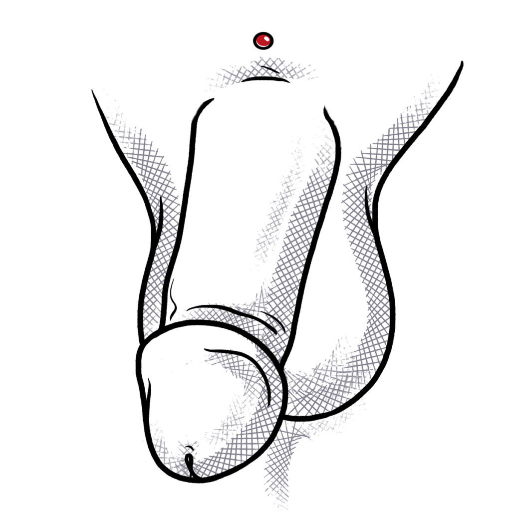 DermalAnchor_Schambein-mann DermalAnchor_Schambein-mann